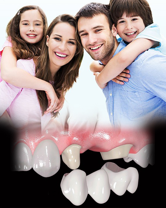 Prótesis dental Benidorm